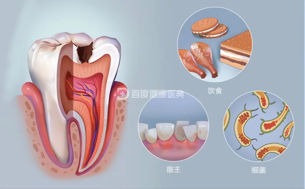 没有牙的叫什么