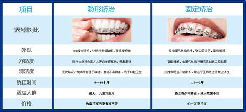 隐形矫治是什么意思,隐形矫治技术与数据实施导向，探索未来矫正领域的革新与融合,完整机制评估_tool24.36.23