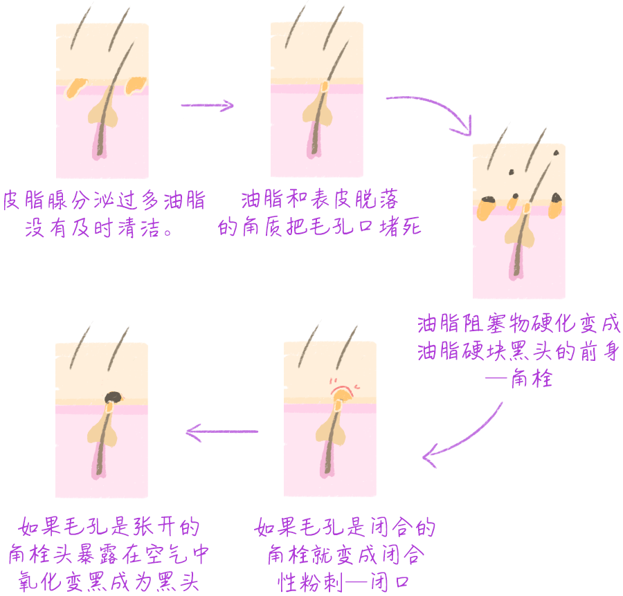 黑头怎么产生的,黑头产生的精确分析解析说明,快速解答解释定义_8K14.48.68
