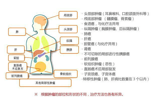 开瓶器的材料分为哪几类,开瓶器的材料分类及其详细数据解释与定义——扩展版87.93.40,创新设计计划_翻版64.11.11