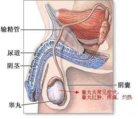 附睾炎的症状是怎么引起的